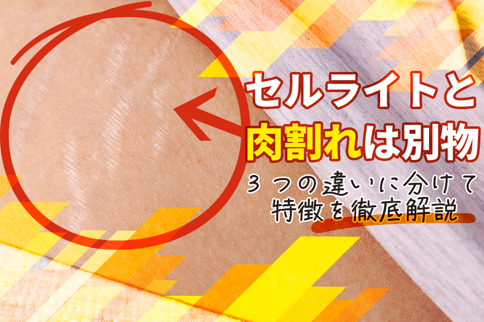 肉割れ