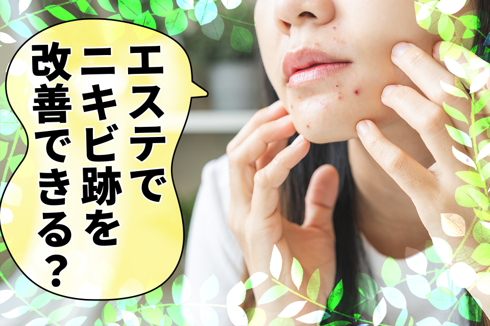 エステでニキビ跡を改善できる？おすすめの施術と得られる効果を解説