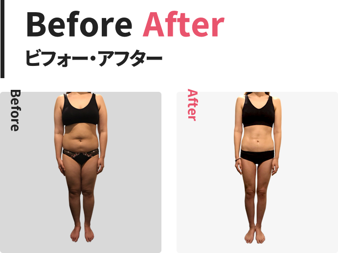 before after